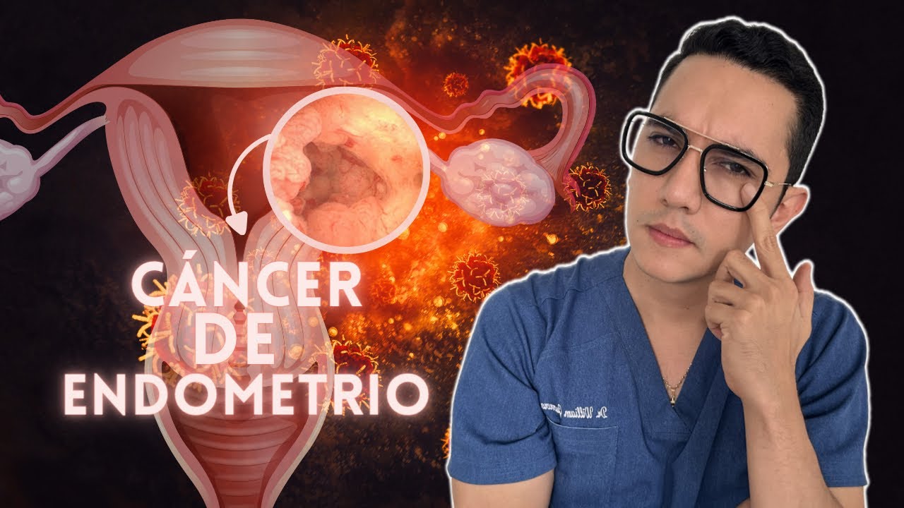 Cáncer de endometrio, síntomas tempranos de alerta | Dr. William Guerrero