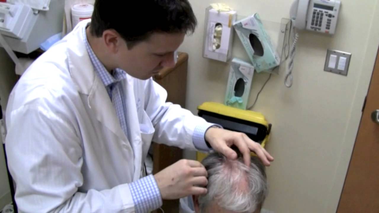Scarring alopecia - Scarring alopecia
