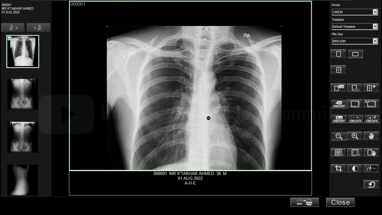 How to Print X-Ray in Console Advance / Free LayOut Print.