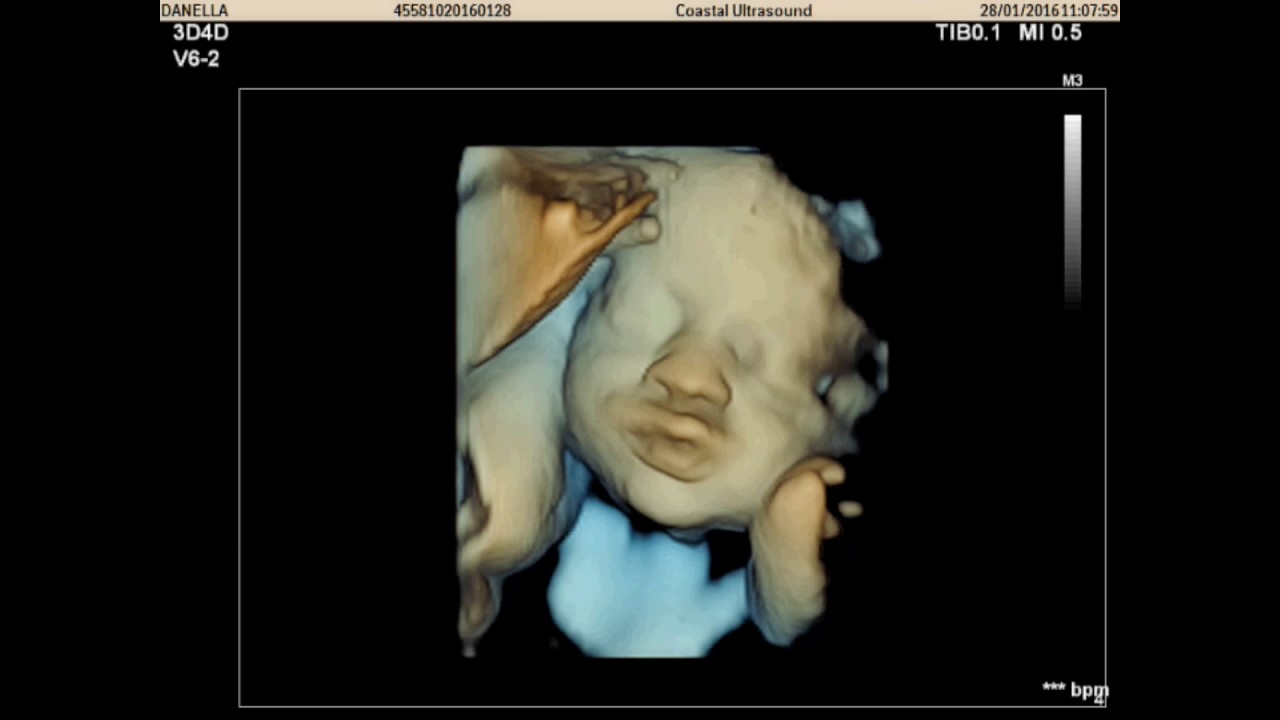 Coastal Ultrasound Welcome To Coastal Ultrasound Gisborne