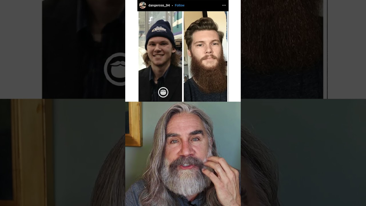 Crazy 26 Yr Old Beard Transformation! 