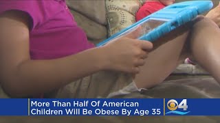More Than Half Of US Children Will Be Obese By 35, Study Says