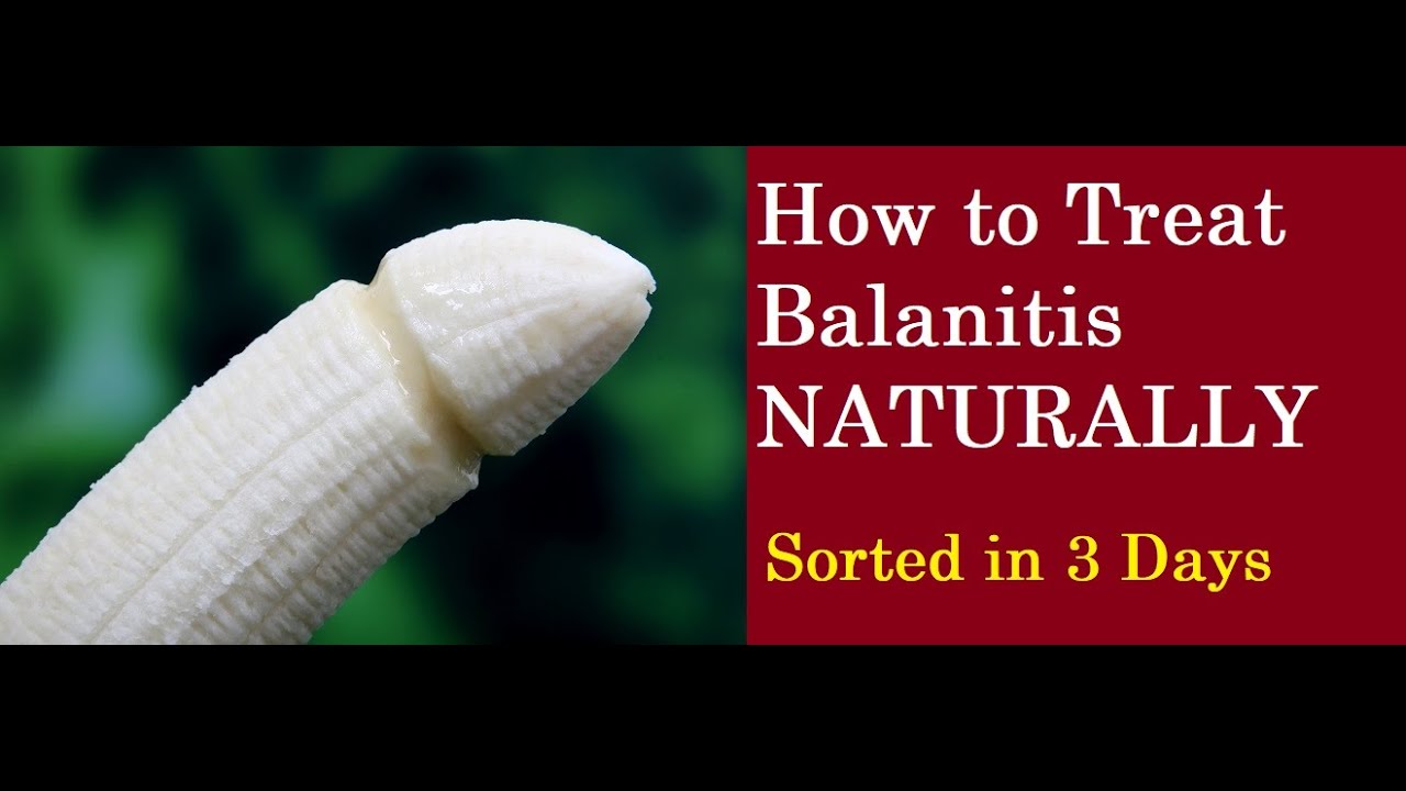 treatment for balanitis