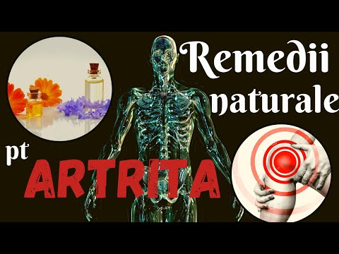 Video: 14 Tratamente Naturiste Pentru Artrita Psoriazică: Turmeric și Altele