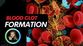 How does blood clot? |Extrinsic vs Intrinsic pathway