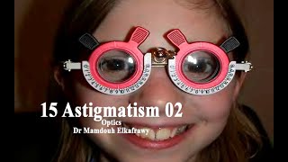 15 Astigmatism Part-2 #الكفراوي #أوبتكس #Elkafrawy #optics (Symptoms)