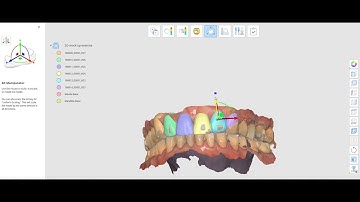Simple 3D mockup using the Medit Design App with the IDDA (Adam Nulty) tooth library