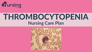 Nursing Care Plan for Thrombocytopenia (Nursing Care Plan Tutorial) screenshot 4