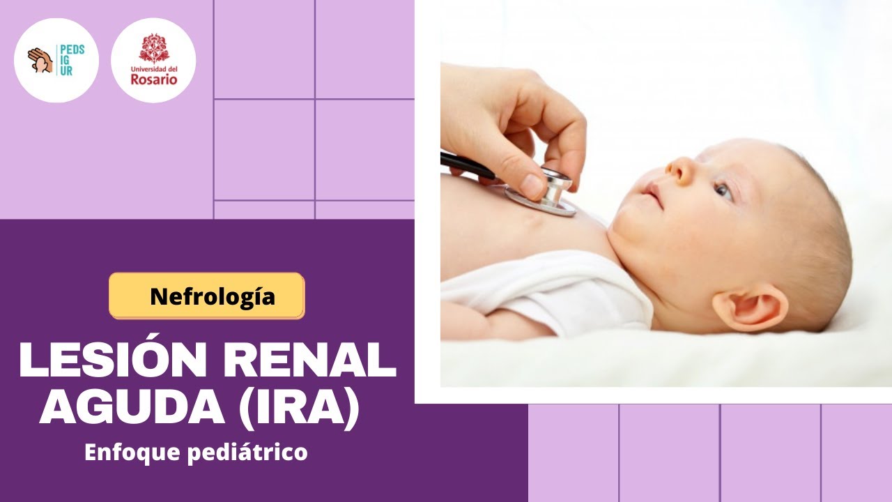 Insuficiencia Renal Aguda en Pediatría - PEDsIgUR, módulo nefrología
