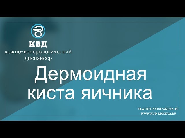 Дермоидная киста