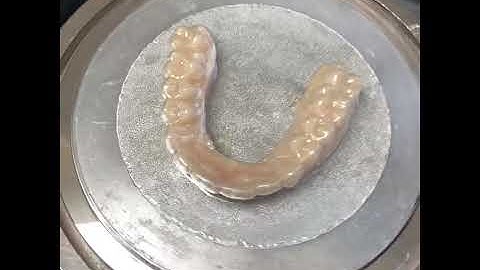 3D Printing Retainers! | Braces And Invisalign | Lander, WY