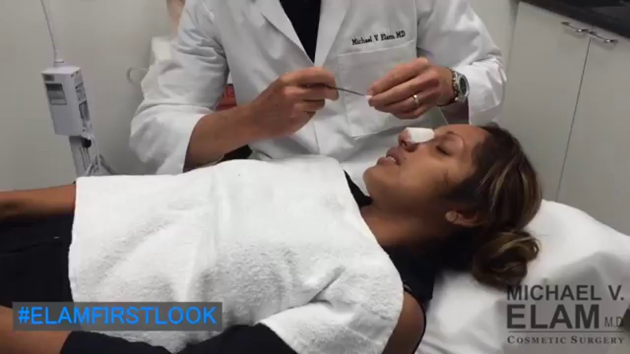 Dr. Michael Elam Reveals His Patient's Nose For The First Time! - 