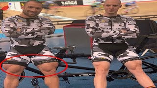 Out of control! A man with monstrous Legs Robert Foerstemann