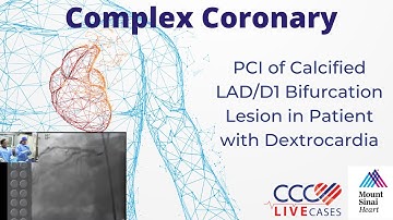 PCI of Calcified LAD/D1 Bifurcation Lesion in Patient w/ Dextrocardia - December 2012 Webcast Video