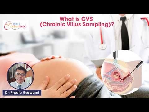 Chorionic Villus Sampling (CVS): What It Is And Why It’s Done? By Dr. Pradip Goswami
