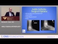 Ankle Fusion and Arthroplasty by Michael Clain, MD