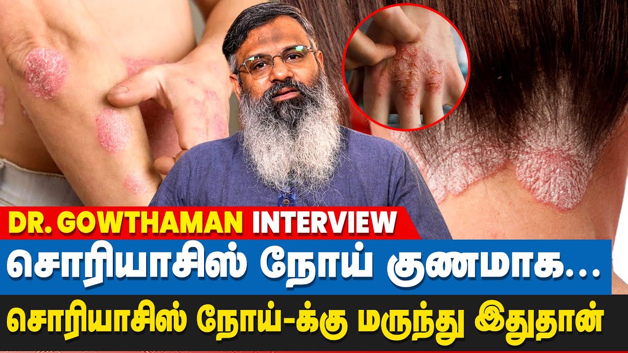சொரியாசிஸ் நோய் குணப்படுத்தும் வழிகள்...| Psoriasis Treatment | Dr Gowthaman Interview