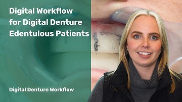Digital Denture Workflow: Digital Workflow For Digital Denture Edentulous Patients