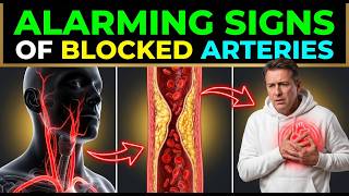 5 Silent Signs of Artery Blockages You Can’t Ignore