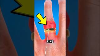 DON’T PULL A STUCK RING! 😱 Try This Simple Trick Instead