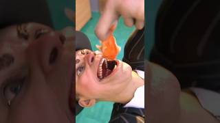 Demi Viral, Mereka Menelan 101 Ikan Mas Sekaligus