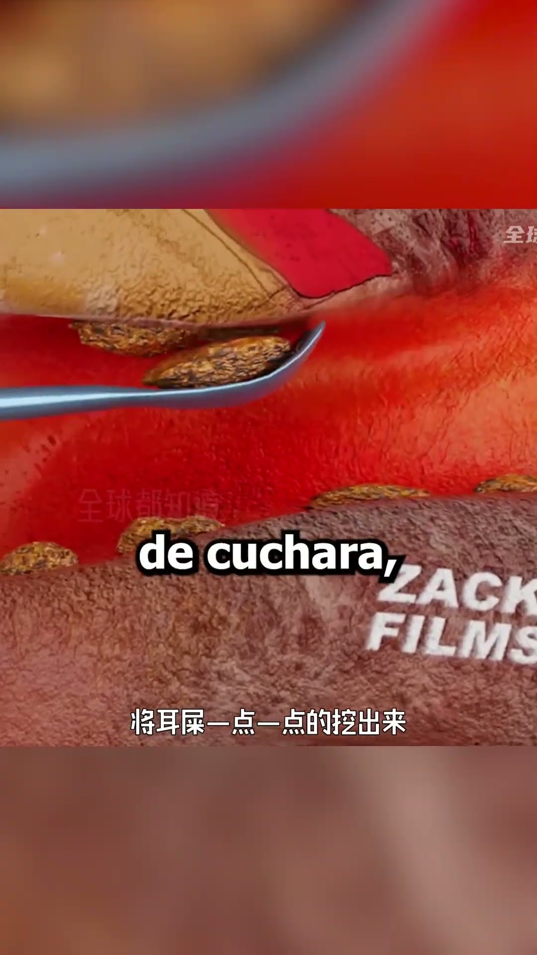 Nunca LIMPIES tus oidos con HISOPOS?