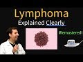 Lymphoma Explained Clearly - Hodgkin's vs Non Hodgkin's Pathology | Remastered