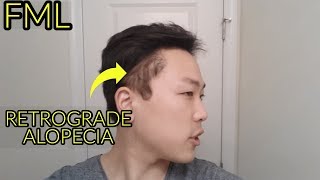 The Truth About My Hair Loss.