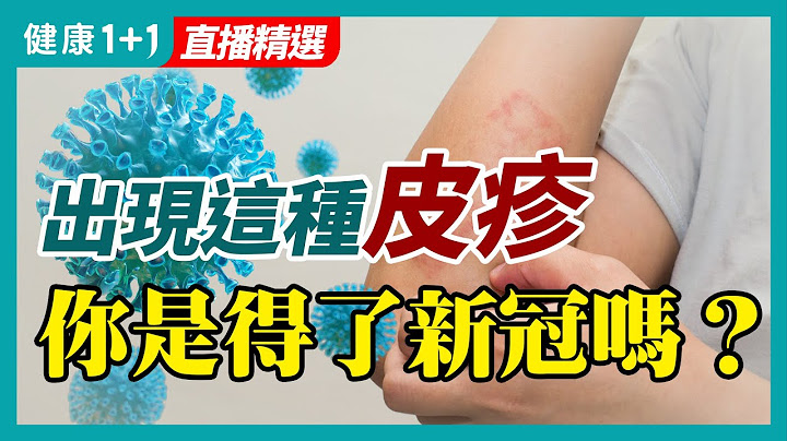 新冠紅疹和普通皮膚病紅疹要怎麼區分？ | 哪些是新冠肺炎病毒感染時可能出現的紅疹呢？ | 健康1+1 - 天天要聞