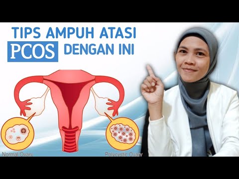 Video: 3 Cara Mengatasi Sindrom Ovarium Polikistik (PCOS)