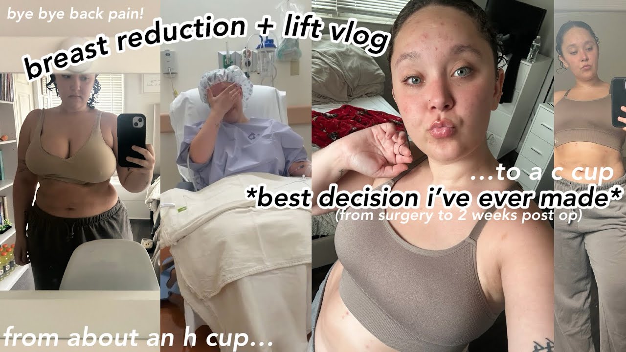 I GOT A BREAST REDUCTION + LIFT | vlog & recovery