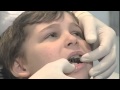 Apparecchi ortodontici in età pediatrica