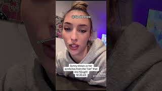 Sunny Shows Us Her Scratches From Fighting Des - Spoiledtea