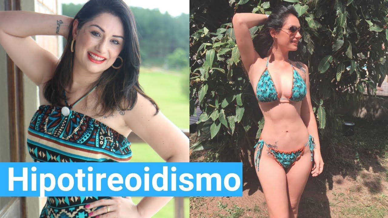 Hipotireoidismo Antes E Depois Do Peso Tireoide: Como Manter A Saúde