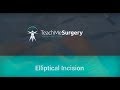 Surgical Skills - Elliptical Incision of a Skin Lesion