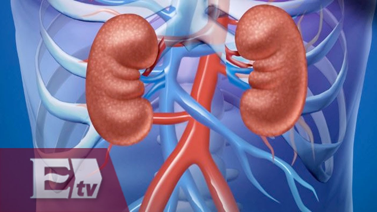 Cuidado y tratamiento del trasplante de riñón / salud con Gloria ...