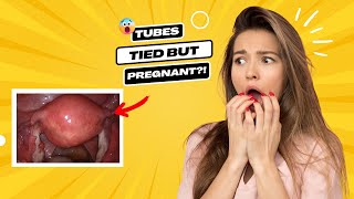 Can You REALLY Get Pregnant with Your Tubes Tied? Facts Revealed!!