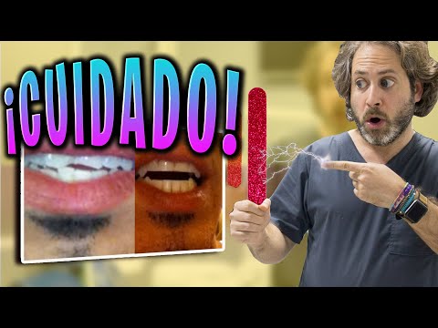 Video: 4 formas de limar un diente afilado