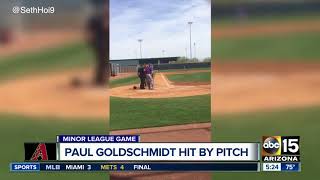 Paul Goldschmidt hit in head by pitch - ABC15 Sports