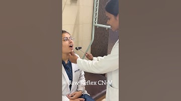 Deep Tendon Reflexes - Physiotherapy Edition 🔨🤌🏻 #medicalstudent #physiotherapy #shorts #ytshorts