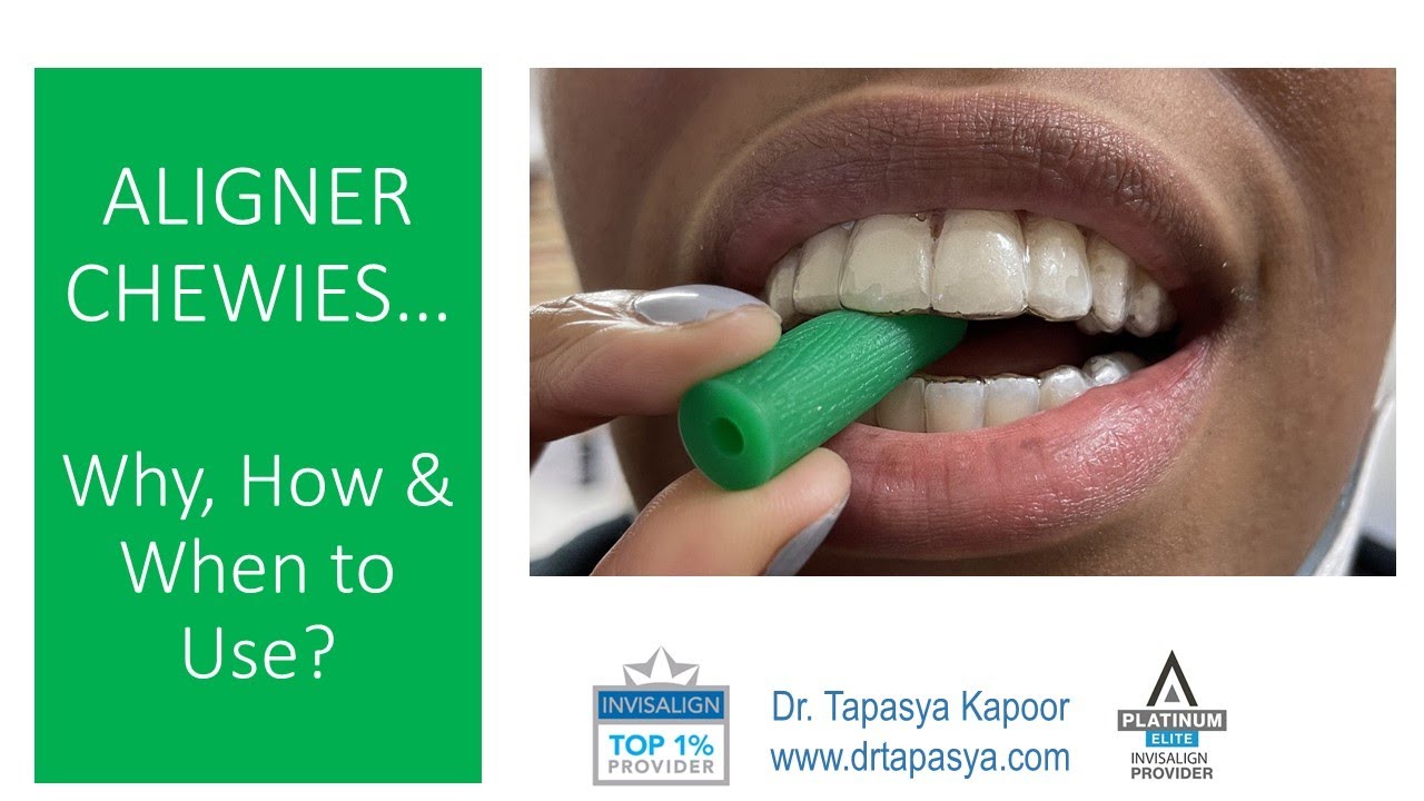 How To Use Aligner Chewies How To Use Aligner Chewies