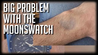 MAJOR PROBLEM With Omega X Swatch - The MoonSwatch