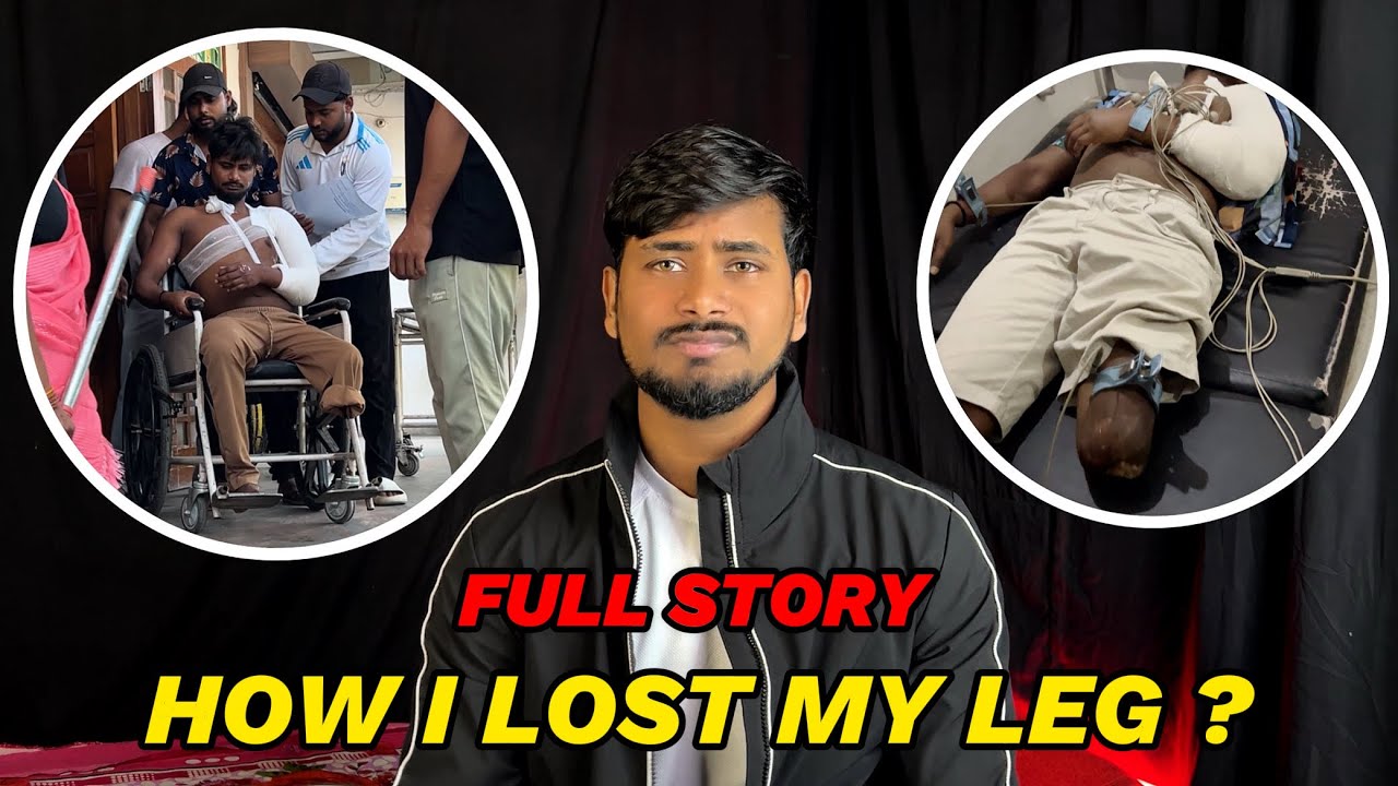 How i lost my leg ? 🥺❤️‍🩹 | theironleg |  