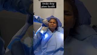 Results of an AWAKE DEEP PLANE FACELIFT