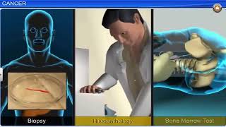 Human Health and Diseases-2 Animation | CBSE Class 12 Biology Animated 3D Video | Neetbharath.in