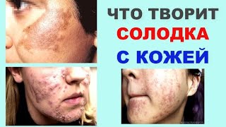 ЧТО творит СОЛОДКА с КОЖЕЙ ?