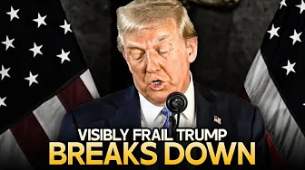 Visibly Frail Trump Cries About Having To Work So Much