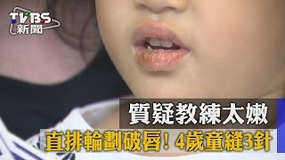 【TVBS】直排輪劃破唇！ 4歲童縫3針質疑教練太嫩