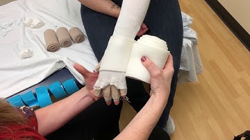 Lymphedema Arm Wrap Bandaging (Part 2)