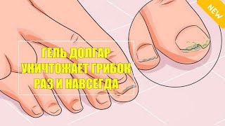 Препараты от грибка ногтей на ногах список